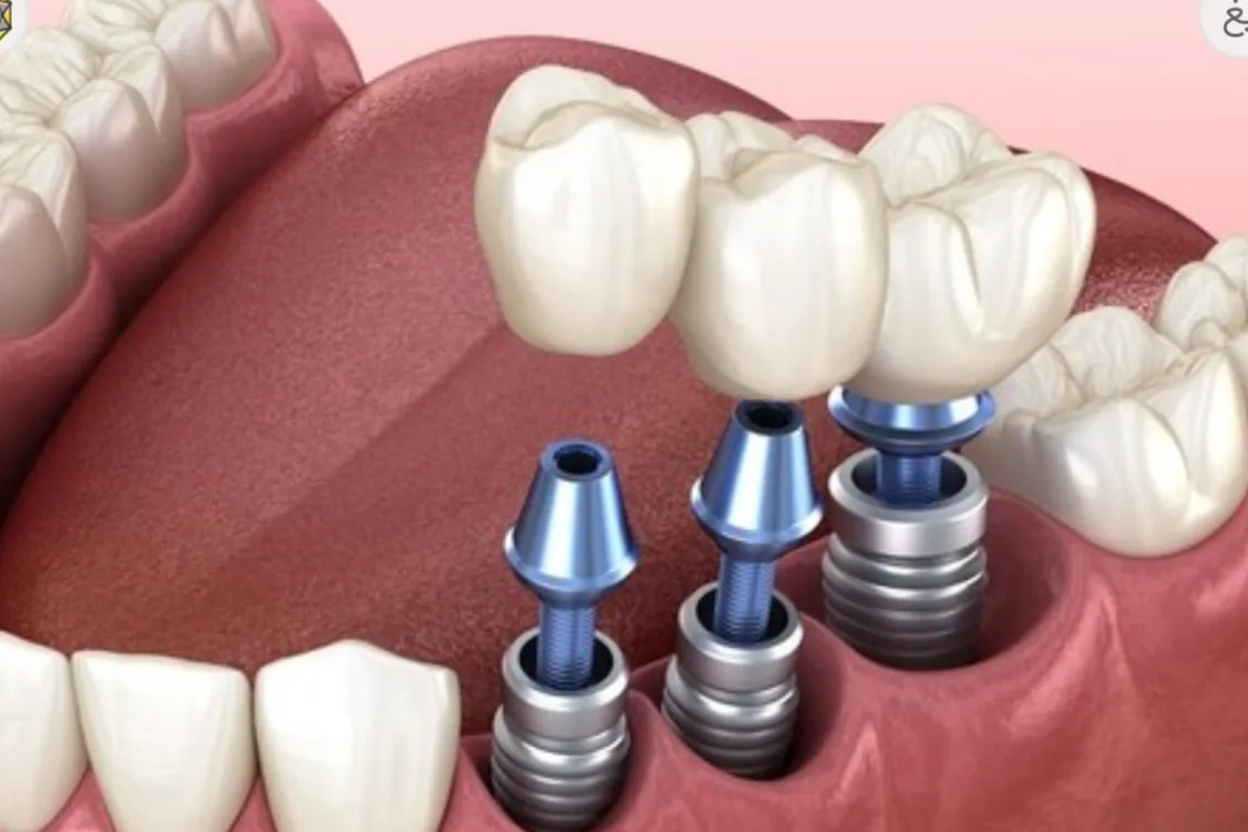 مطب دندان پزشکی دکتر مرتضوی - تصویر 4