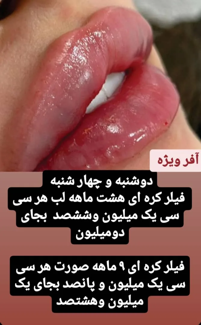مرکز لیزر و زیبایی دکتر یعقوب اصفهانی - تصویر 4