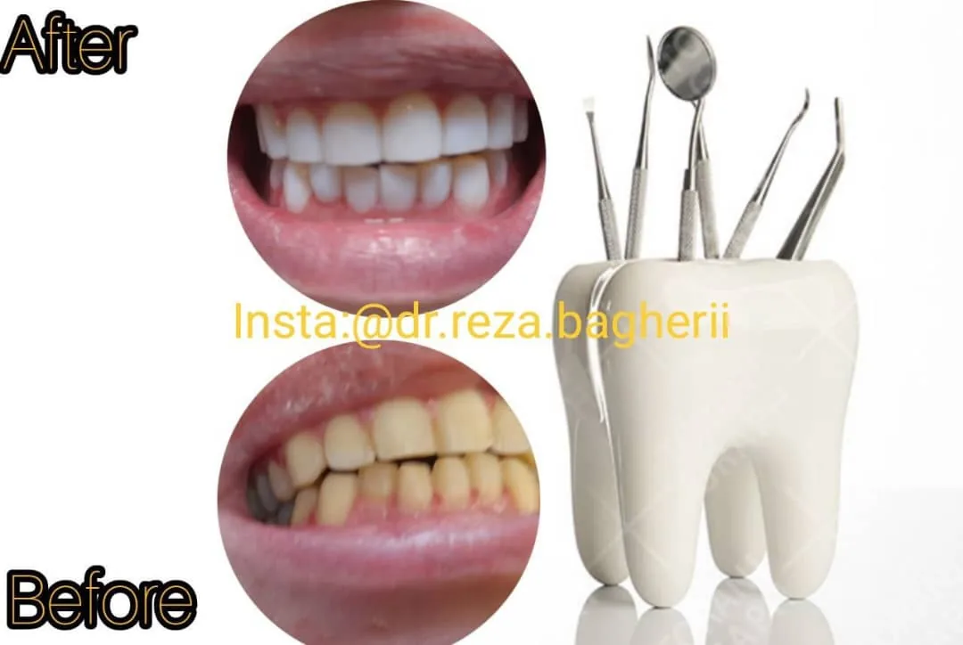 دندانپزشکی دکتر باقری - تصویر 2