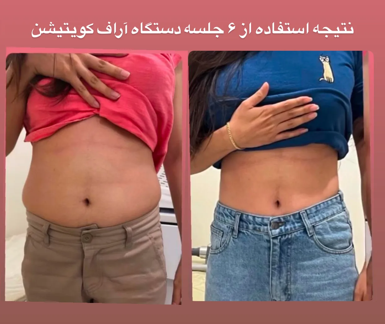 کلینیک زیبایی، لیزر و تغذیه دکتر حسنلو - تصویر 2