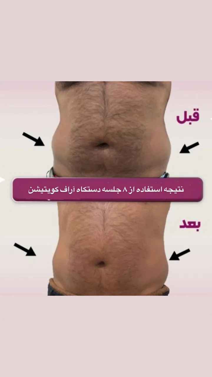 کلینیک زیبایی، لیزر و تغذیه دکتر حسنلو - تصویر 3