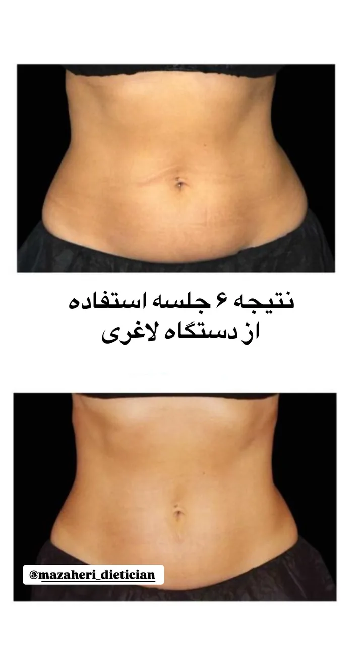 کلینیک زیبایی، لیزر و تغذیه دکتر حسنلو - تصویر 4