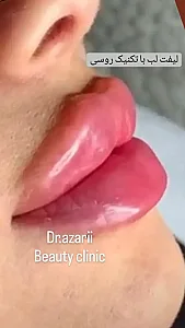 کلینیک پوست مو و زیبایی دکتر آذری