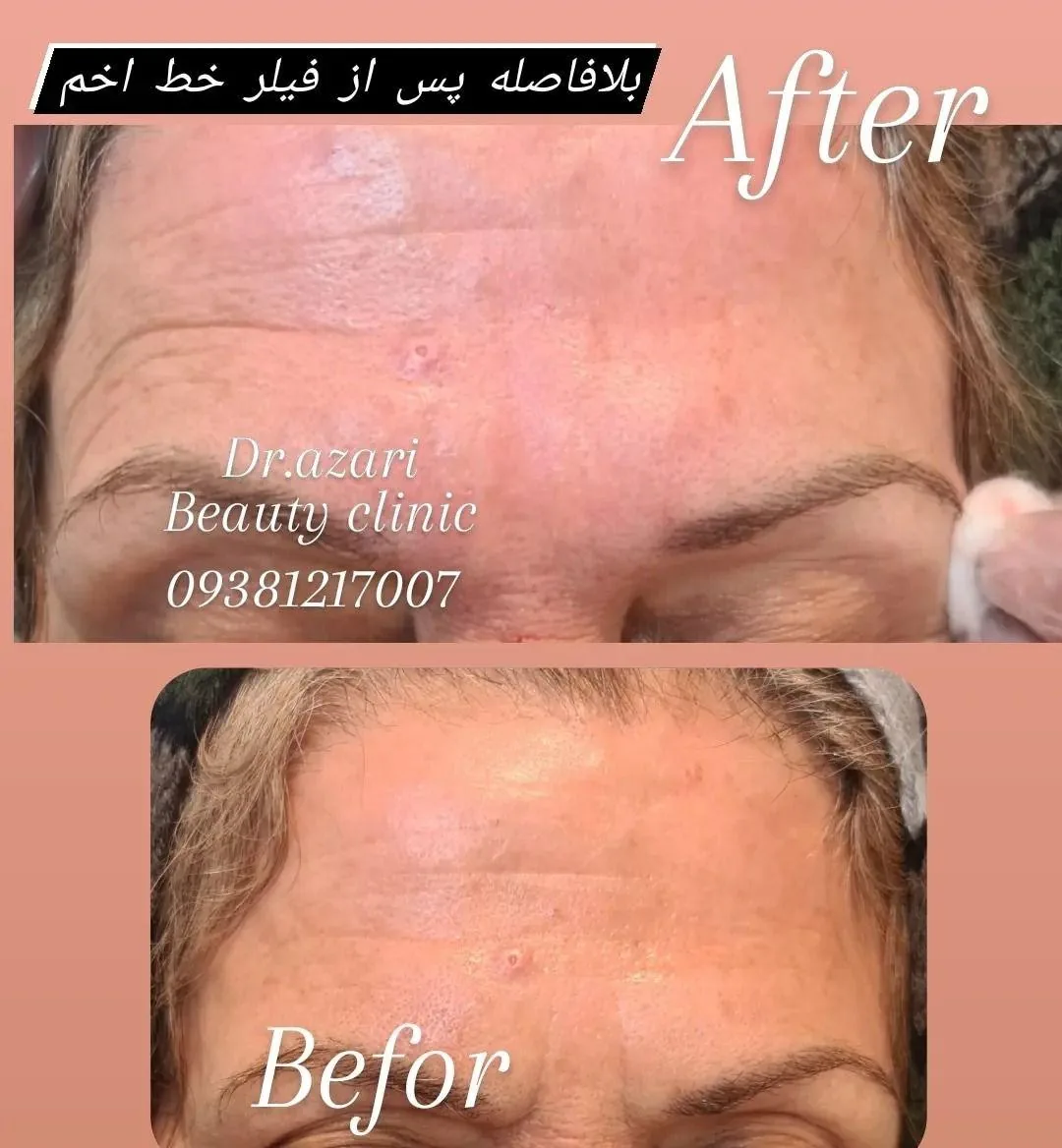 کلینیک پوست مو و زیبایی دکتر آذری - تصویر 2