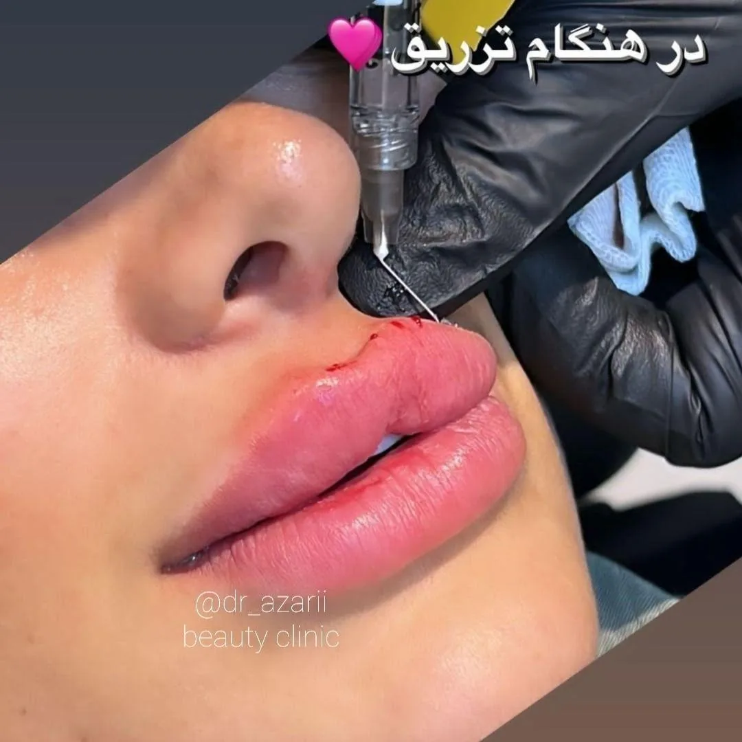 کلینیک پوست مو و زیبایی دکتر آذری - تصویر 3