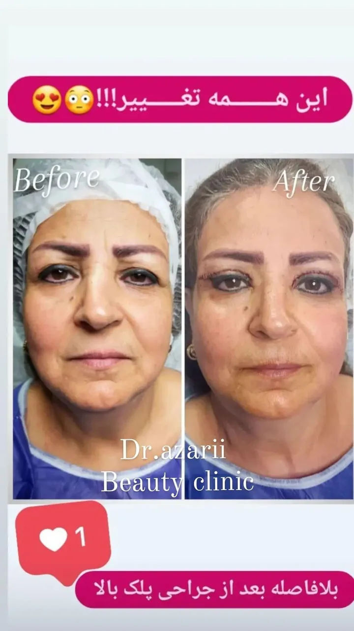 کلینیک پوست مو و زیبایی دکتر آذری - تصویر 4