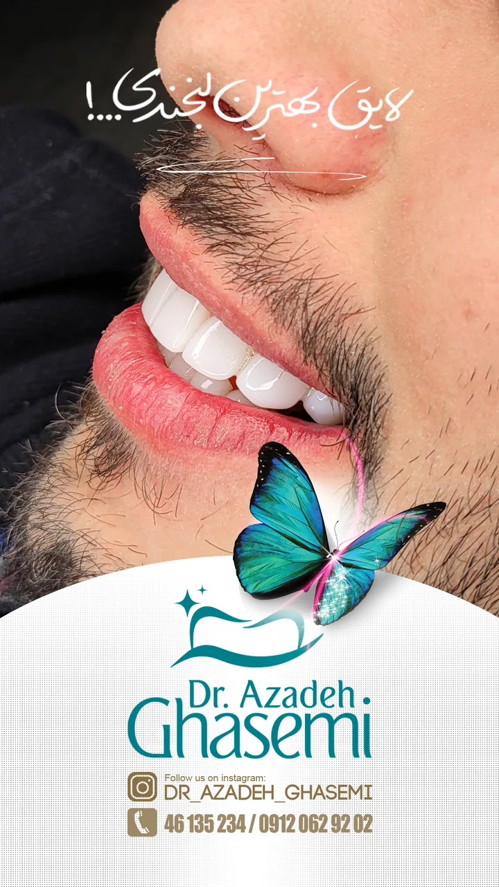 دندانپزشکی دکتر آزاده قاسمی(بیمه داریم) - تصویر 2