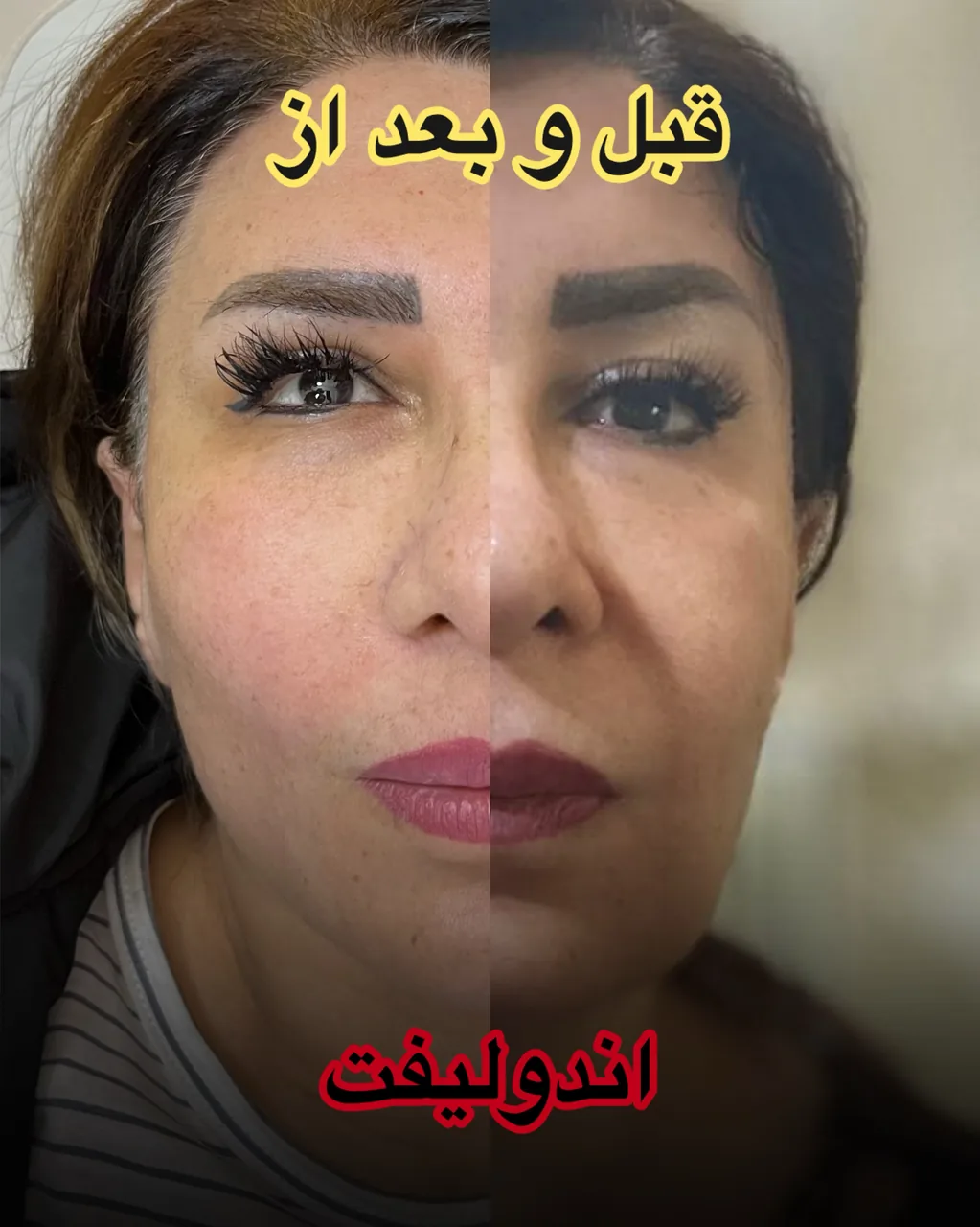 کلینیک اندولیفت پوست و زیبایی دکتر مریمی - تصویر 2