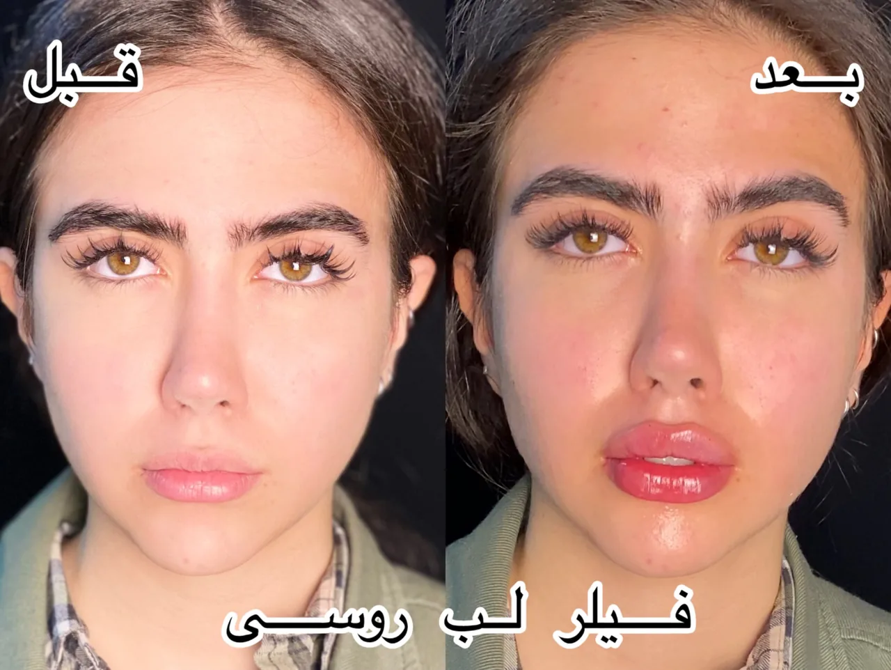کلینیک اندولیفت پوست و زیبایی دکتر مریمی - تصویر 4