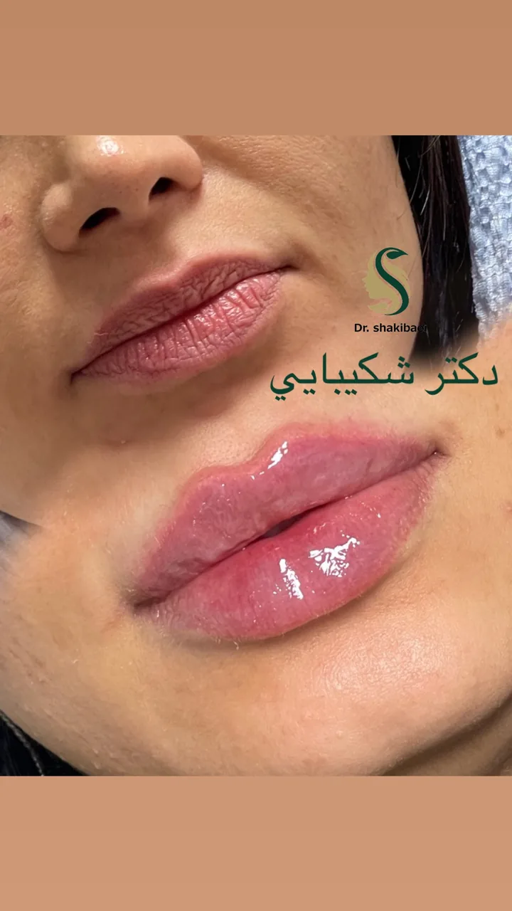 کلینیک پوست مو لیزر دکتر شکیبایی - تصویر 3