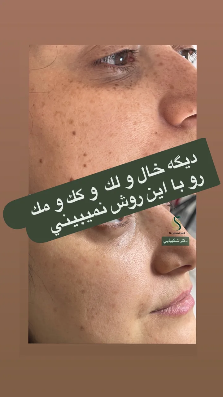 کلینیک پوست مو لیزر دکتر شکیبایی - تصویر 4