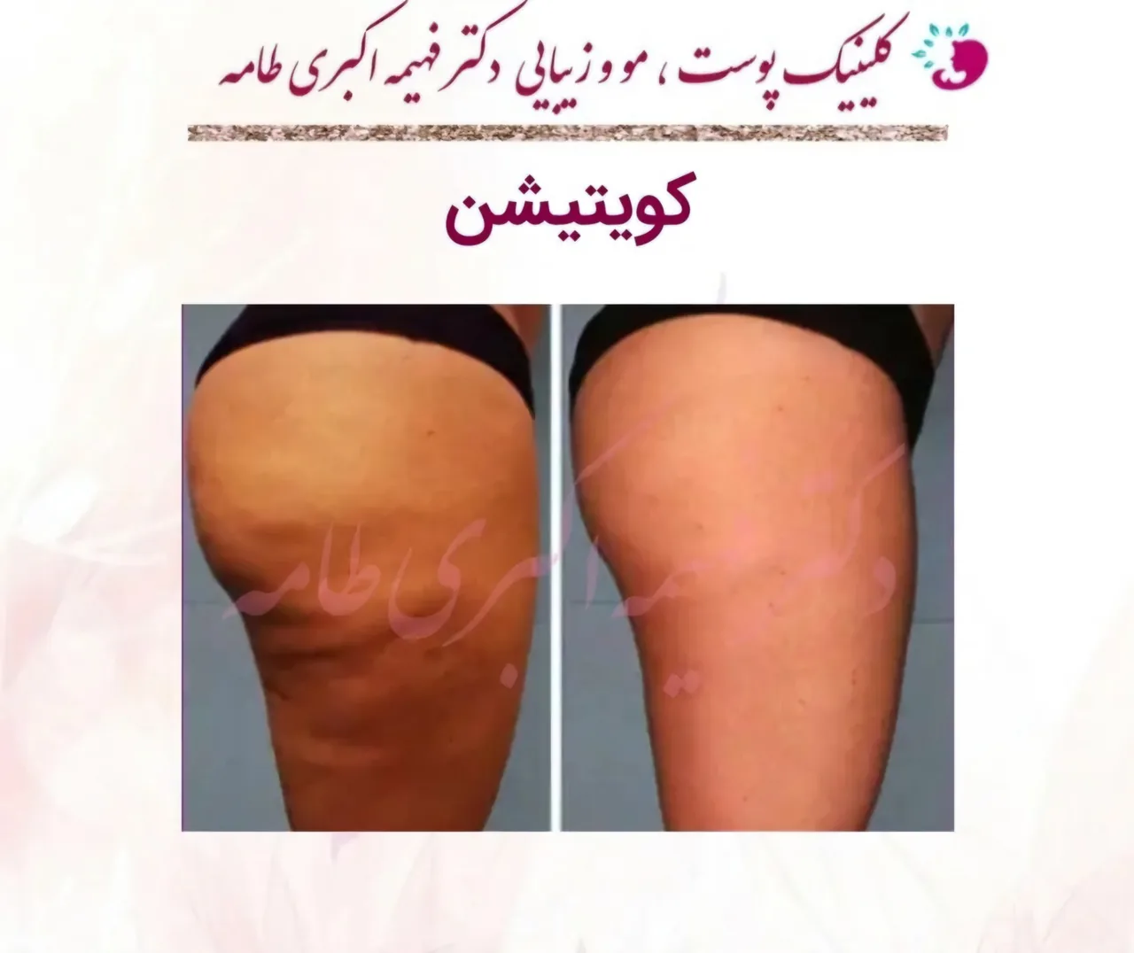 کلینیک پوست ، لیزر و زیبایی دکتر طامه - تصویر 2