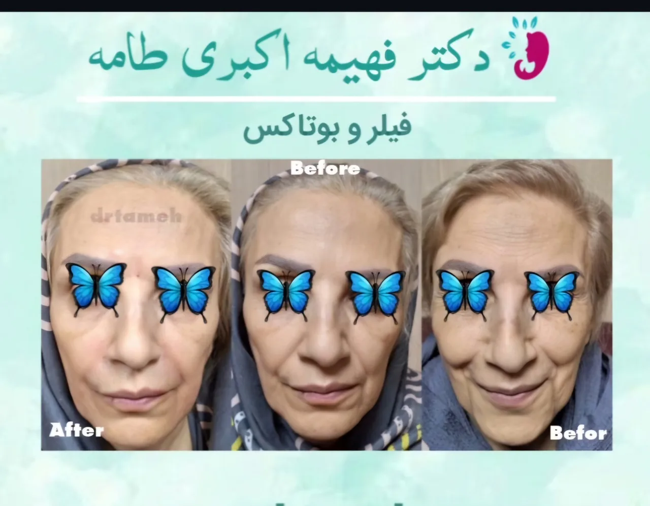 کلینیک پوست ، لیزر و زیبایی دکتر طامه - تصویر 3