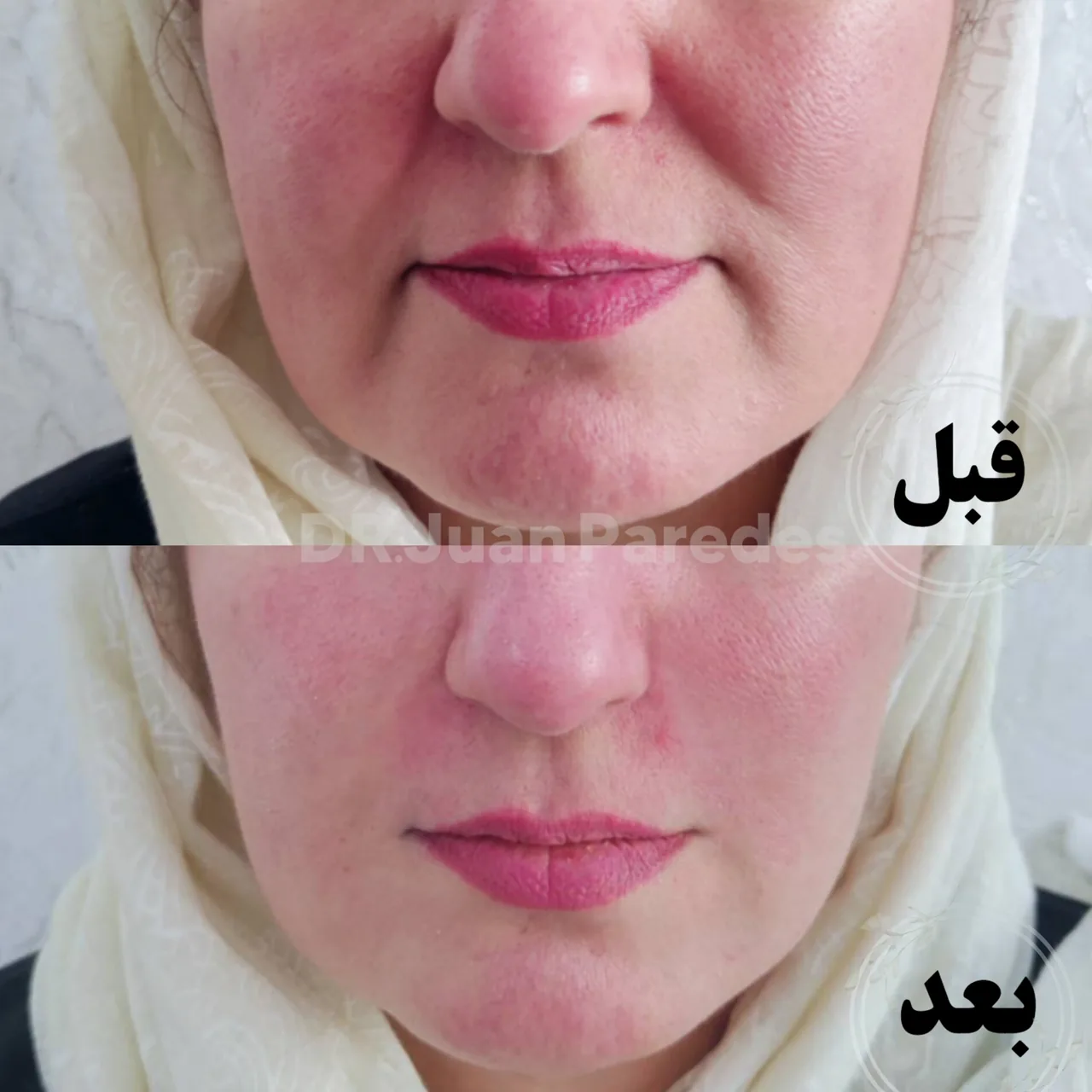 کلینیک زیبایی دکتر خوآن پاردس - تصویر 3