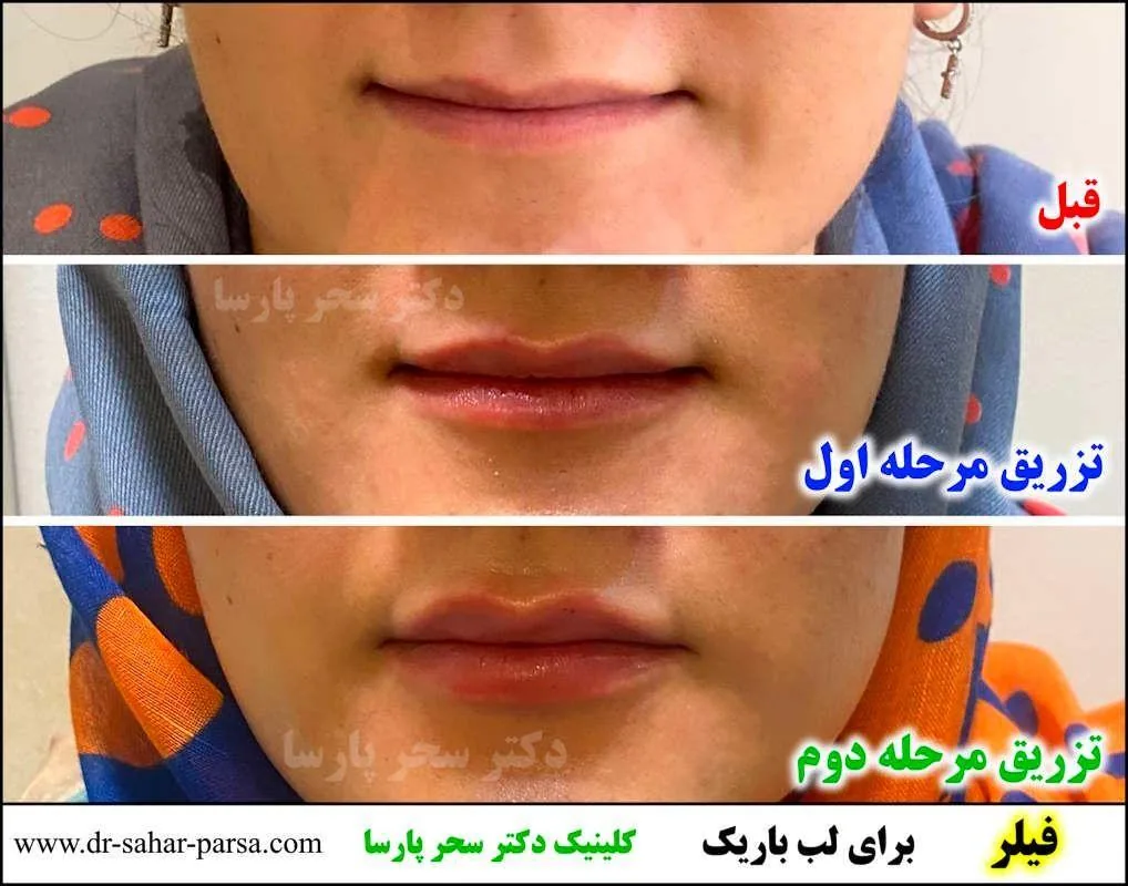 مرکز لیزر و کلینیک زیبایی دکتر پارسا - تصویر 2
