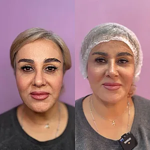 کلینیک پوست مو و زیبایی دکتر زلفی
