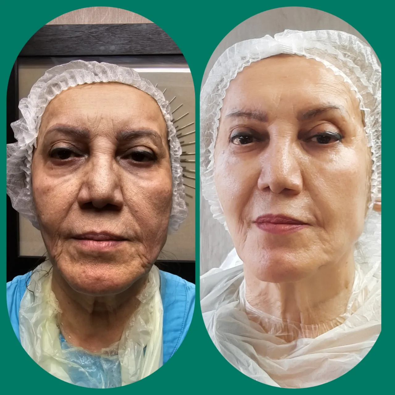 مطب پوست ،مو و لیزر یسنا طب - تصویر 2