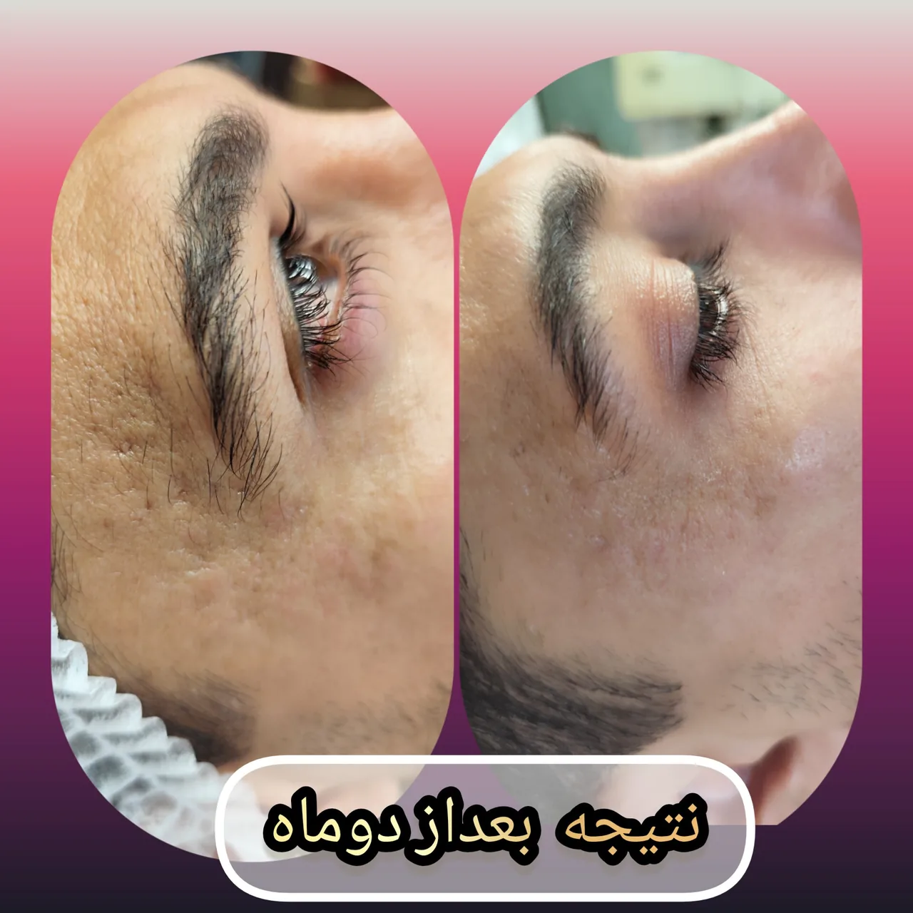 مطب پوست ،مو و لیزر یسنا طب - تصویر 3