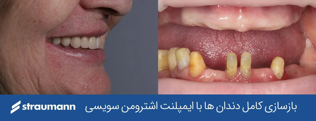 کلینیک دندانپزشکی دکتر علیرضا میرزایی - تصویر 3