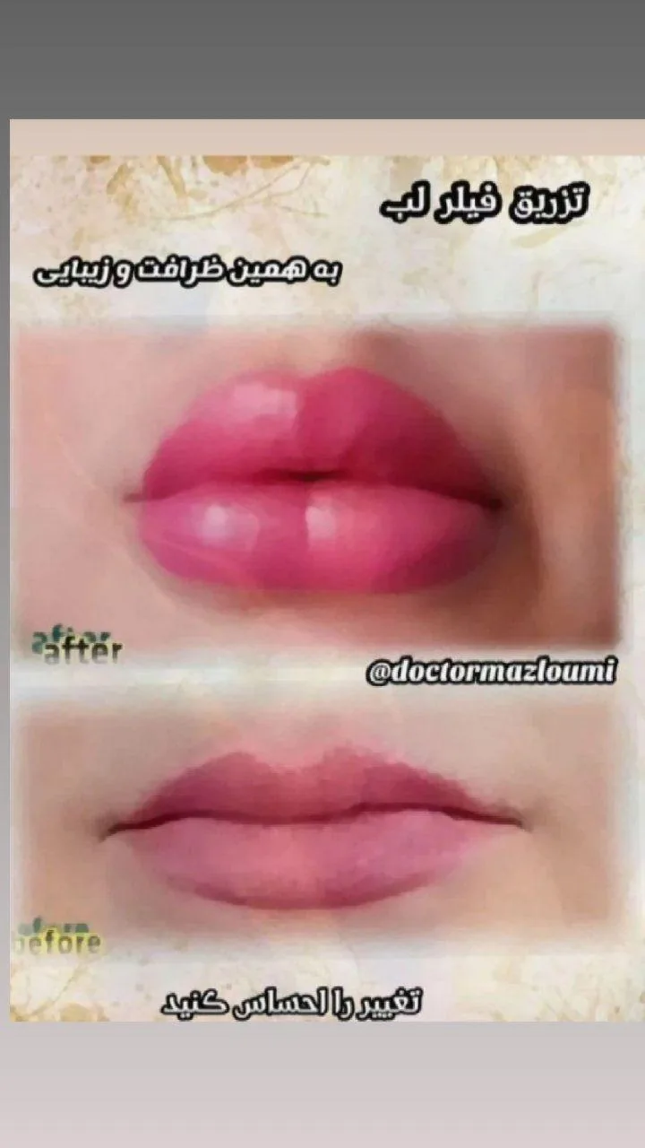 متخصص زیبایی دکتر سید حسن مظلومی