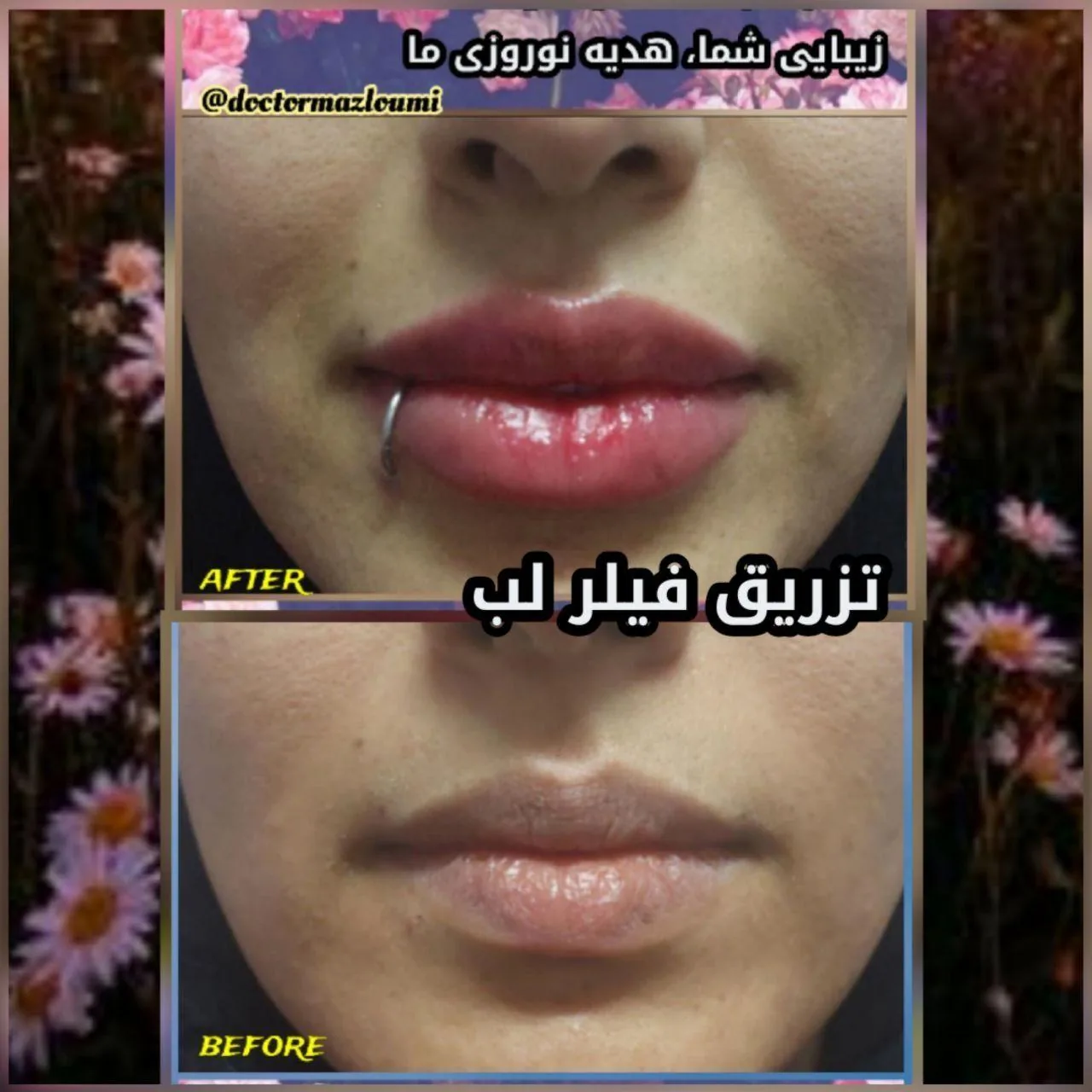 متخصص زیبایی دکتر سید حسن مظلومی - تصویر 2