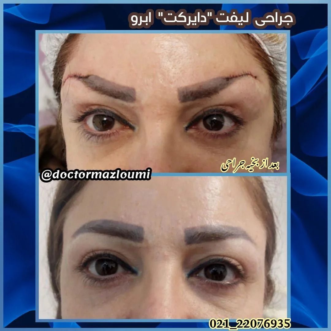متخصص زیبایی دکتر سید حسن مظلومی - تصویر 3