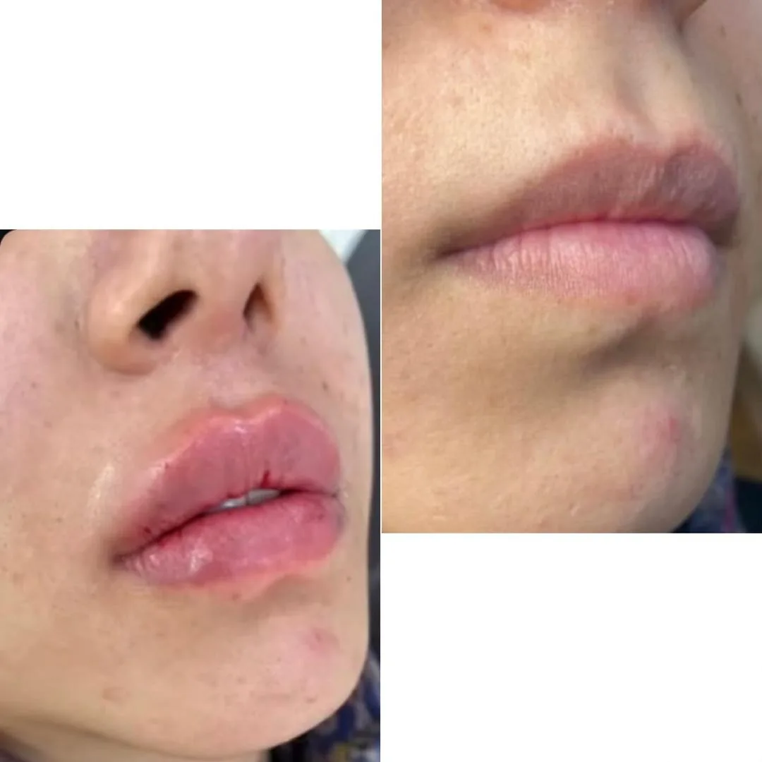 مطب زیبایی دکتر الهه کریمی - تصویر 2