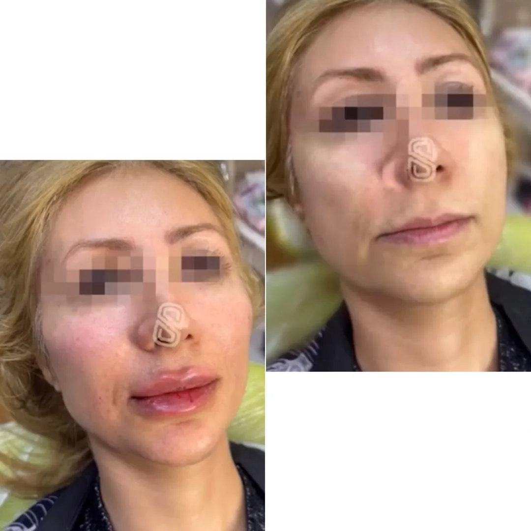 مطب زیبایی دکتر الهه کریمی - تصویر 3