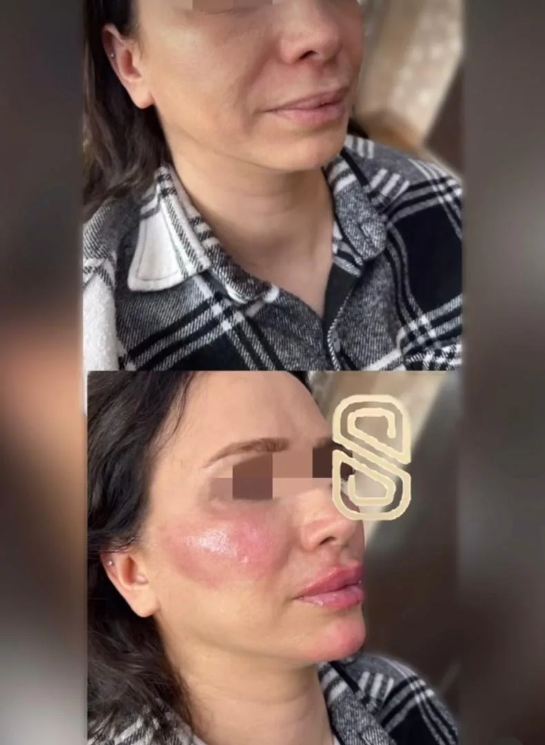 مطب زیبایی دکتر الهه کریمی - تصویر 4