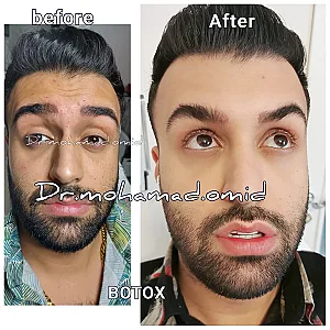 دکتر محمد امید بهترین دکتر زیبایی کانتور