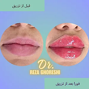 کلینیک پوست و زیبایی دکتر رضا قرشی