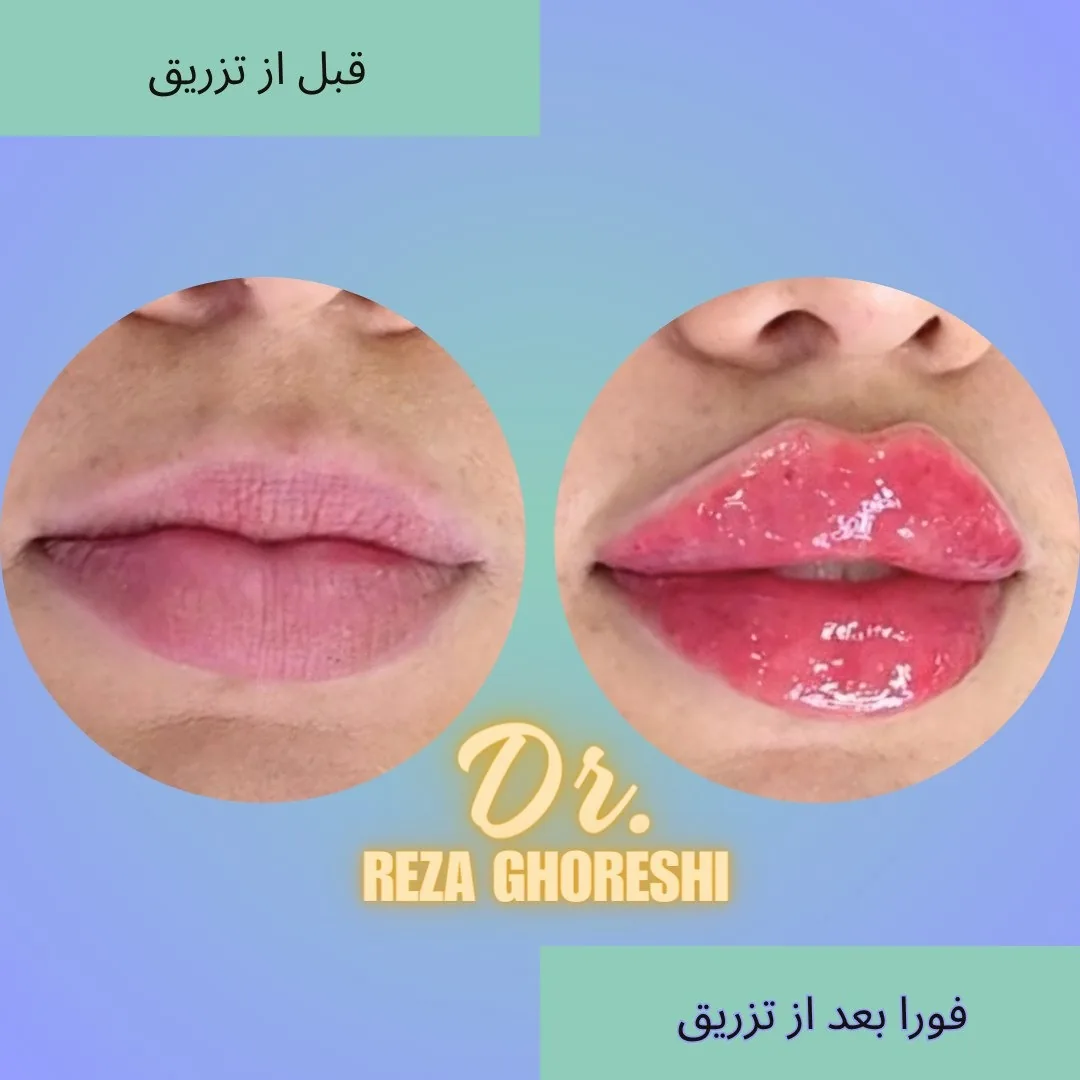 کلینیک پوست و زیبایی دکتر رضا قرشی