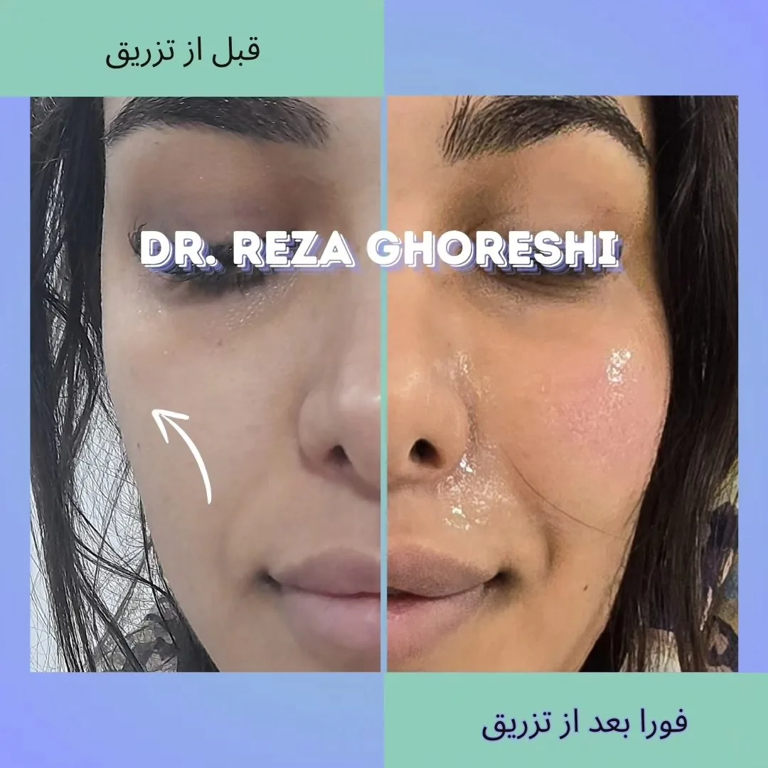 کلینیک پوست و زیبایی دکتر رضا قرشی - تصویر 2