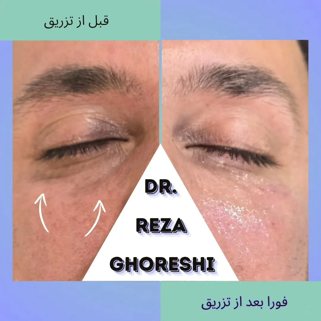 کلینیک پوست و زیبایی دکتر رضا قرشی - تصویر 3