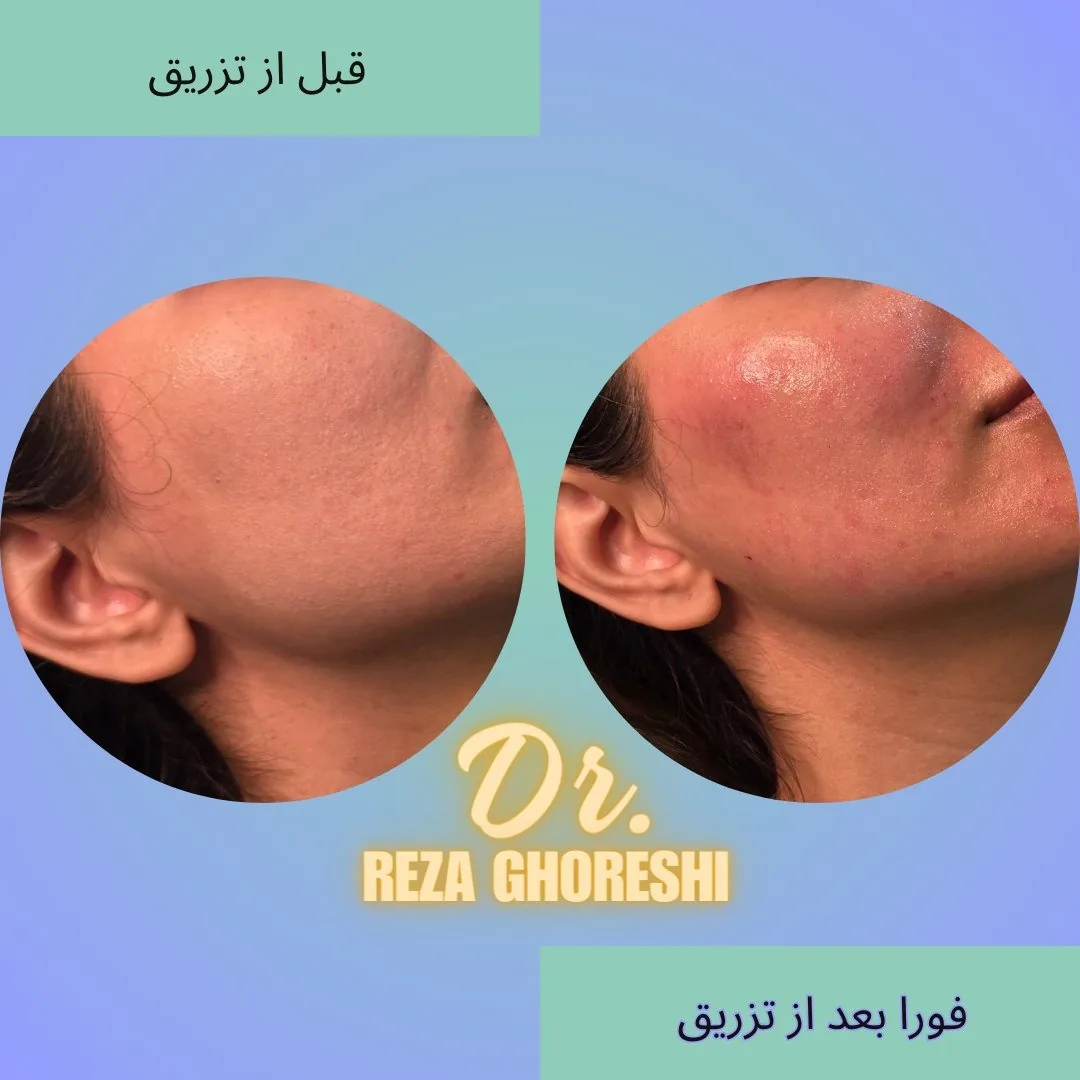 کلینیک پوست و زیبایی دکتر رضا قرشی - تصویر 4