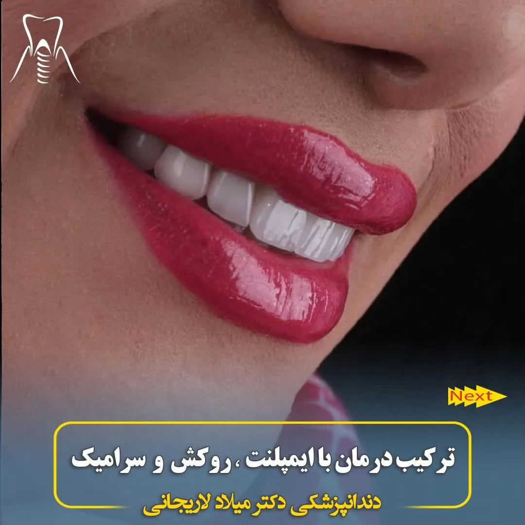 کلینیک دندانپزشکی دکتر لاریجانی - تصویر 4