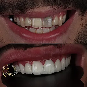 مطب دندانپزشکی دکتر میترا نرماشیری