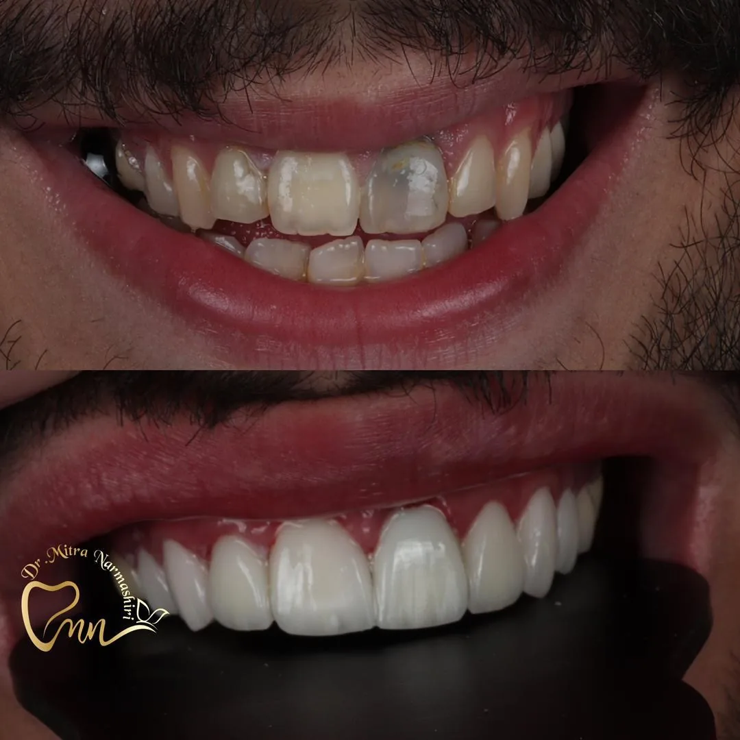 مطب دندانپزشکی دکتر میترا نرماشیری