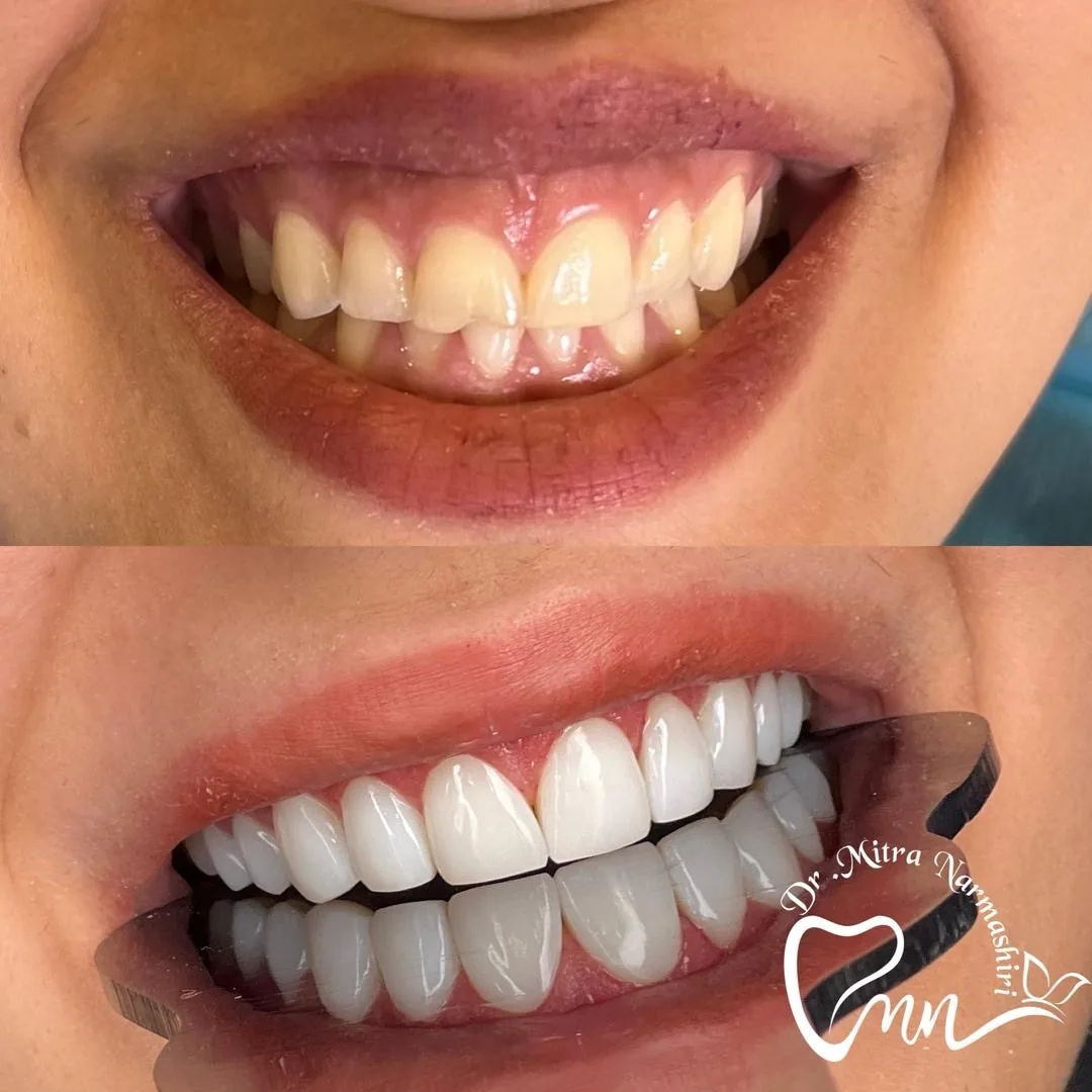 مطب دندانپزشکی دکتر میترا نرماشیری - تصویر 3