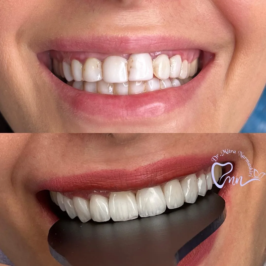 مطب دندانپزشکی دکتر میترا نرماشیری - تصویر 4