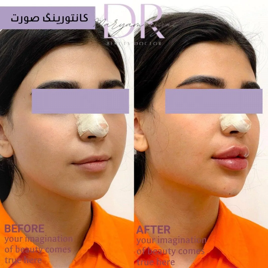 مطب پوست مو و لیزر دکتر مریم ضیایی - تصویر 3