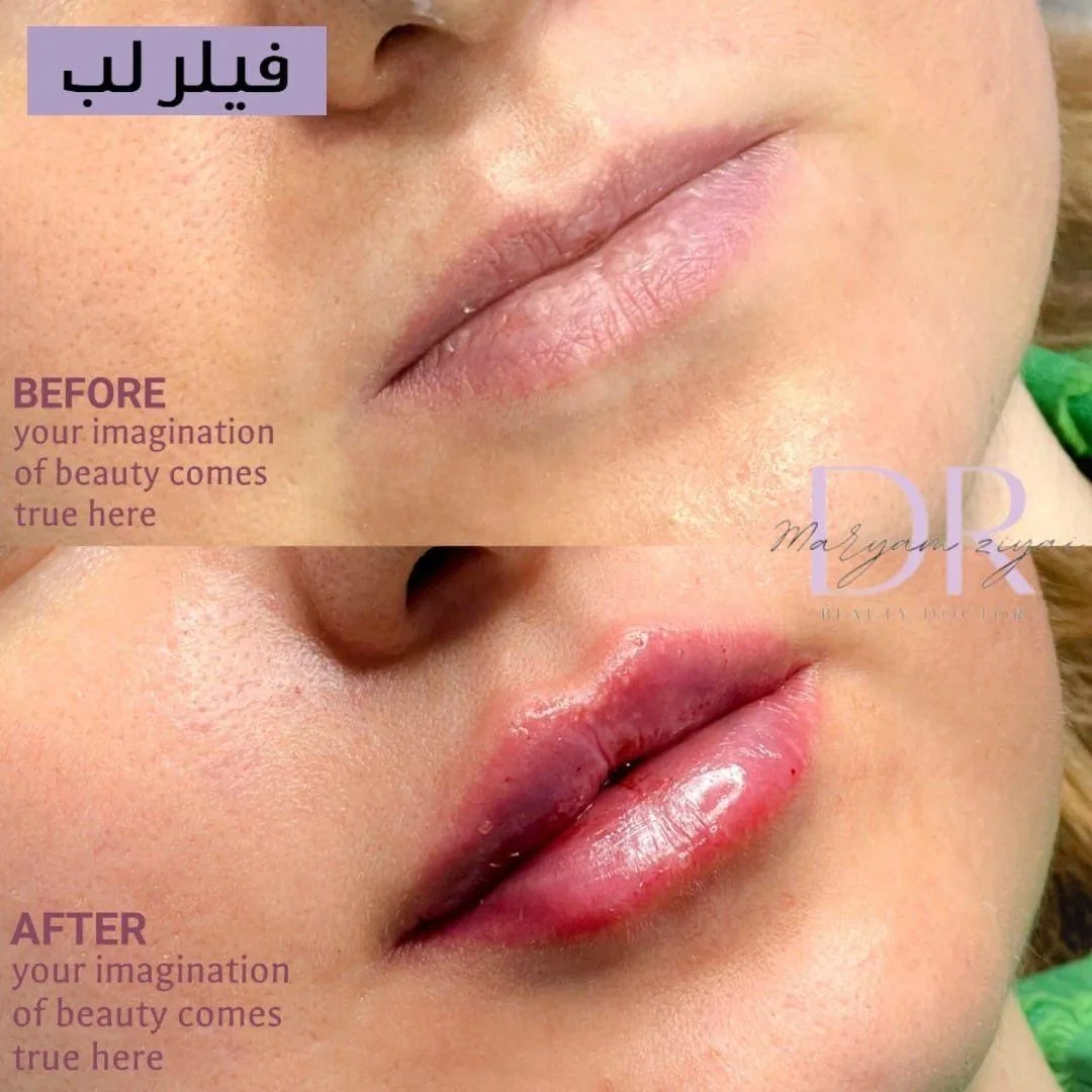 مطب پوست مو و لیزر دکتر مریم ضیایی - تصویر 4