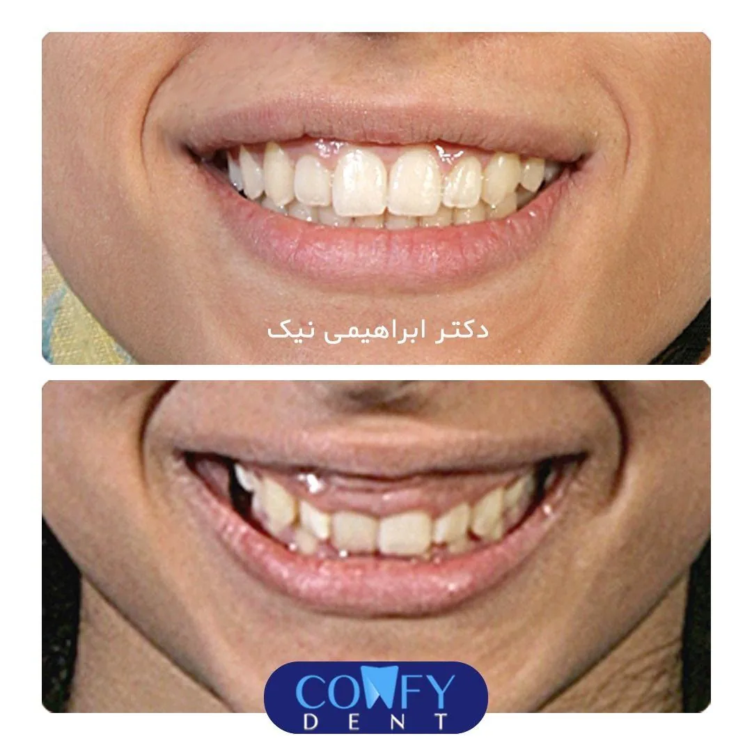 دکتر زهرا ابراهیمی نیک متخصص ارتودنسی و ناهنجاریهای فک و صورت - تصویر 2