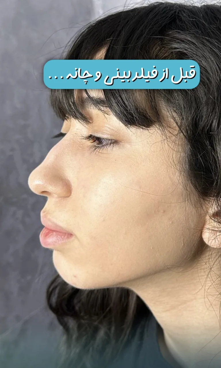 کلینیک زیبایی و لیزر دکتر حکیم پور - تصویر 2