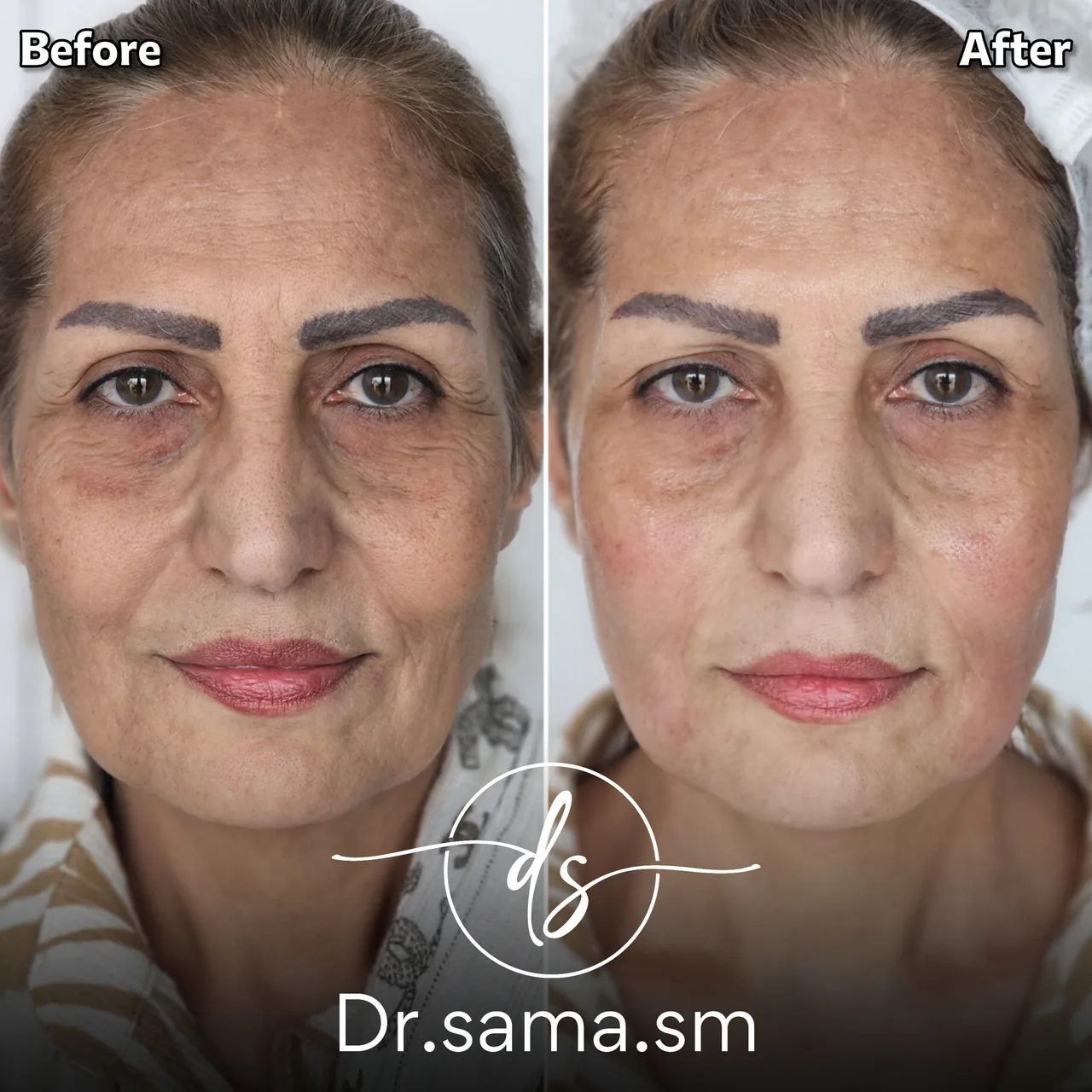 مطب پوست و مو زیبایی دکتر سما - تصویر 3
