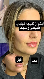 کلینیک زیبایی دکتر فاطمه کوچالی