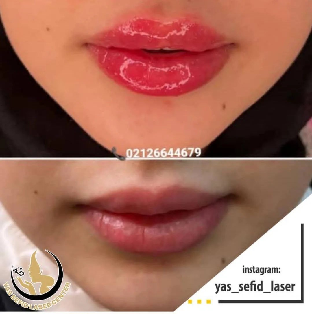 کلینیک زیبایی پوست و مو یاس سفید دکتر سحر رجبیان - تصویر 2