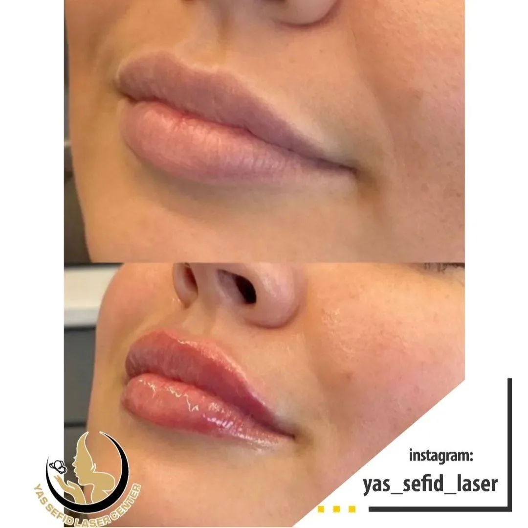 کلینیک زیبایی پوست و مو یاس سفید دکتر سحر رجبیان - تصویر 3