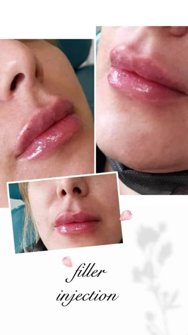 کلینیک زیبایی دکتر فرشاد رحیمی - تصویر 2