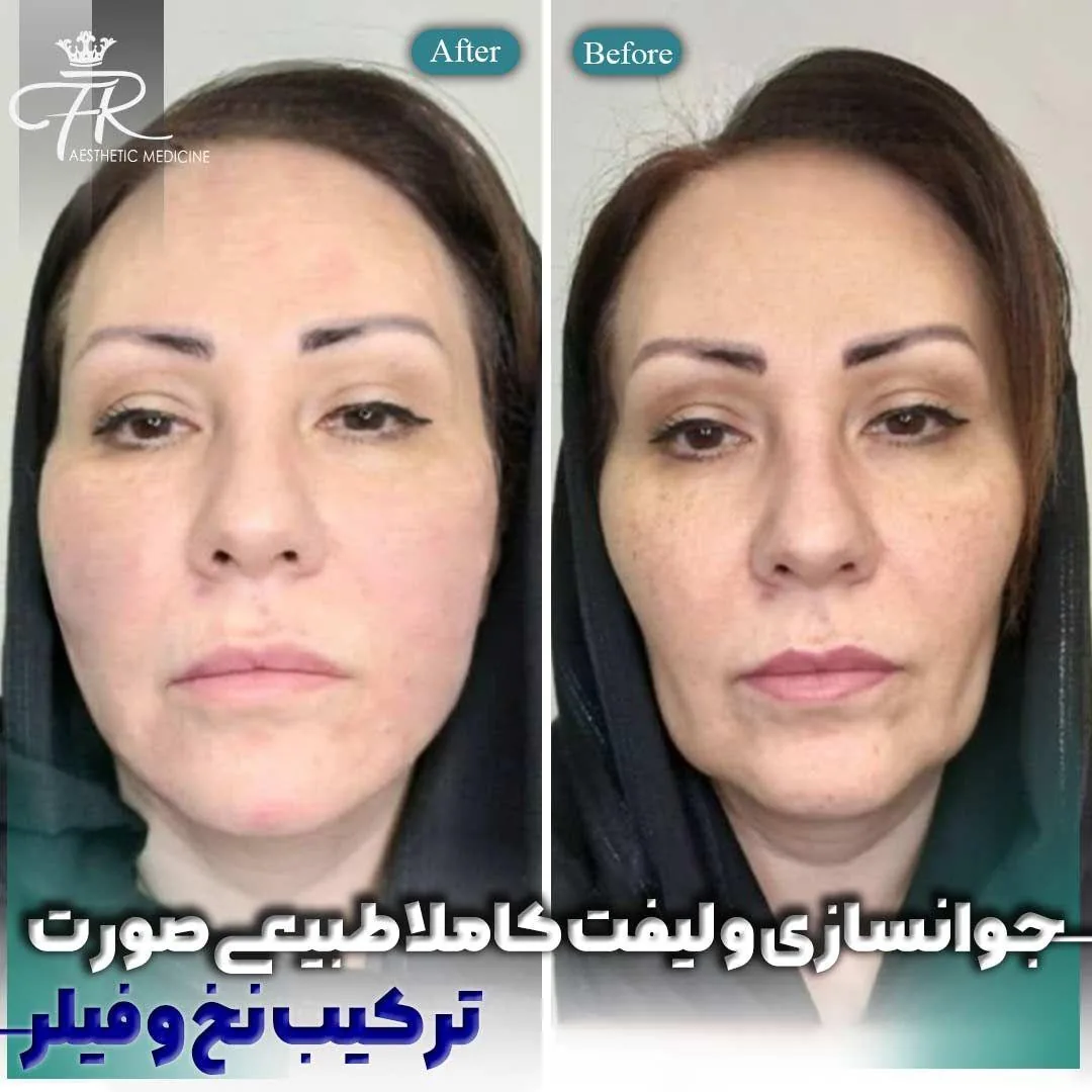 کلینیک زیبایی دکتر فرشاد رحیمی - تصویر 4
